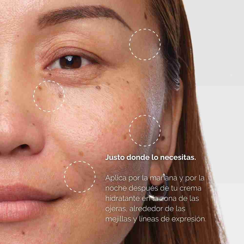 VOLUFILINE* 92% + PAL-ISOLEUCINE 1% (SUERO RELLENADOR  FOCALIZADO)